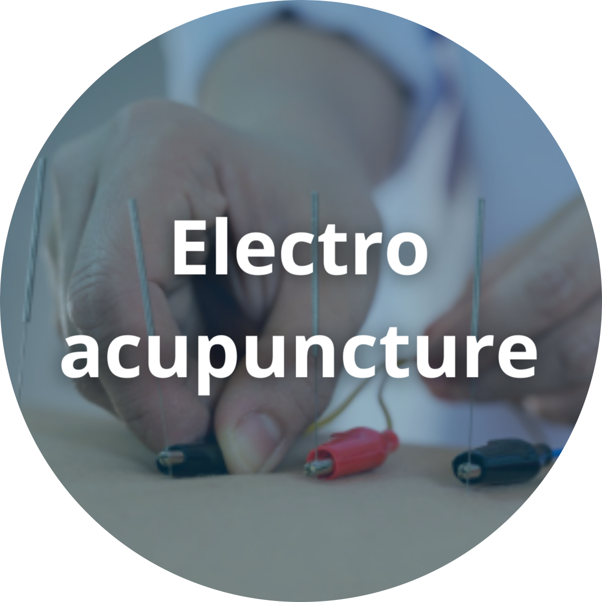 Electro Acupuncture