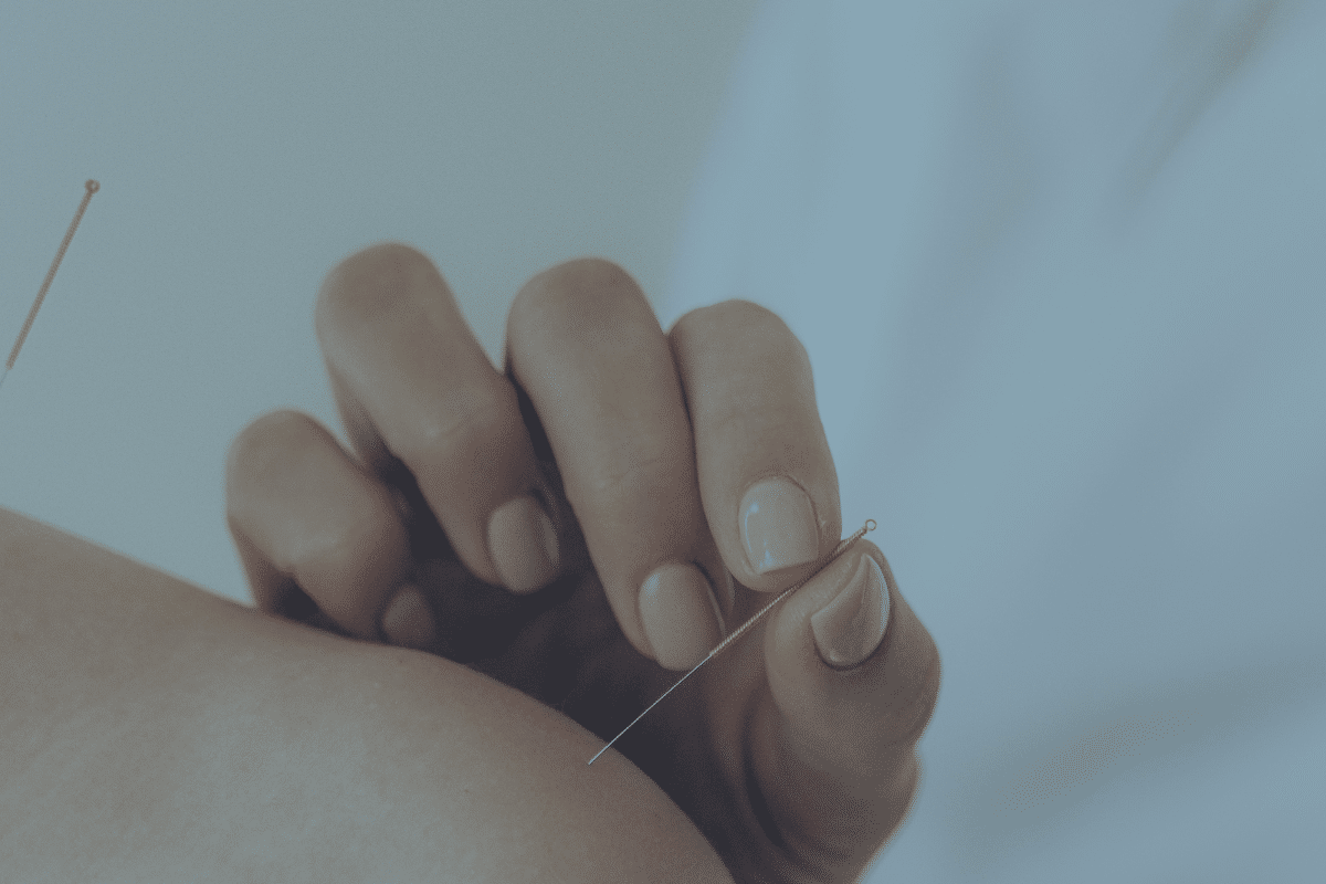 Acupuncture