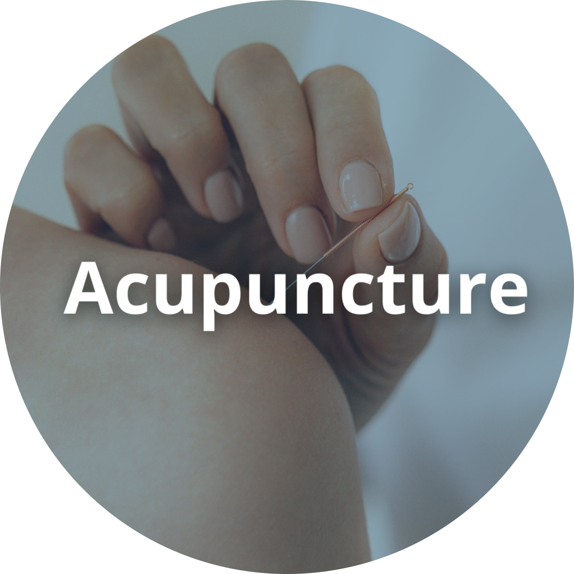 Acupuncture