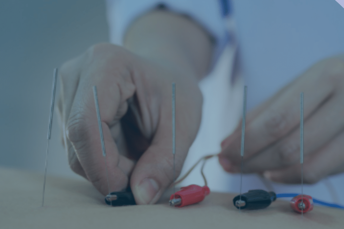 Electro Acupuncture